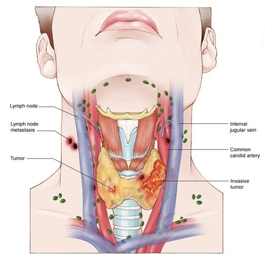 nutritionist in Madhya Pradesh for Thyroid